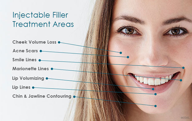 What are dermal fillers? Dermal fillers help to diminish facial lines and  restore volume and fullness in the face. As we age, our faces naturally  lose subcutaneous fat. The facial muscles are
