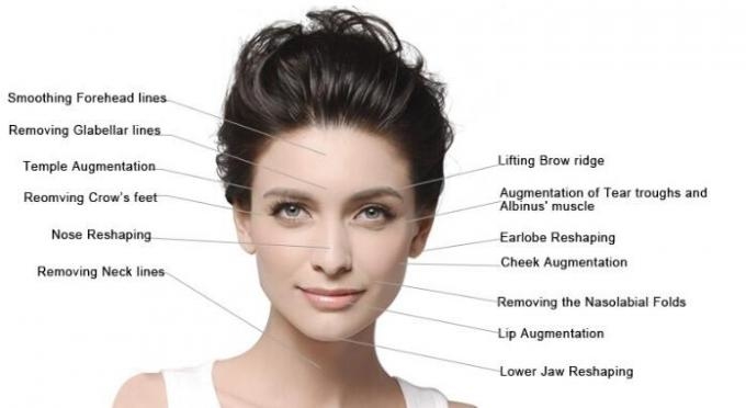 Neuramis Korea Original 1ml Hyaluron ic Acid Deep, derm al filler